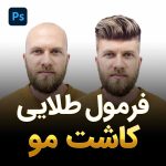 فرمول طلایی کاشت مو